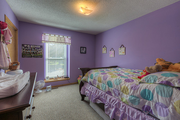 7612W155ST-17